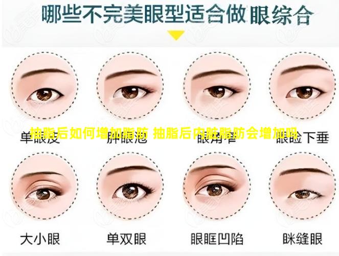 抽脂后如何增加脂肪 抽脂后内脏脂肪会增加吗